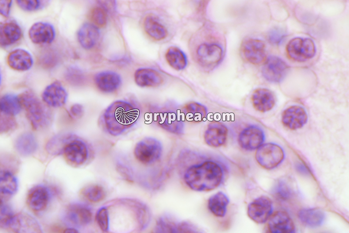 Ganglion lymphatique x800 - gryphea.com